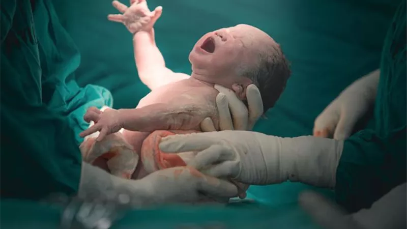 حالة من الرعب والجدل بعد ولادة طفل بعين واحدة