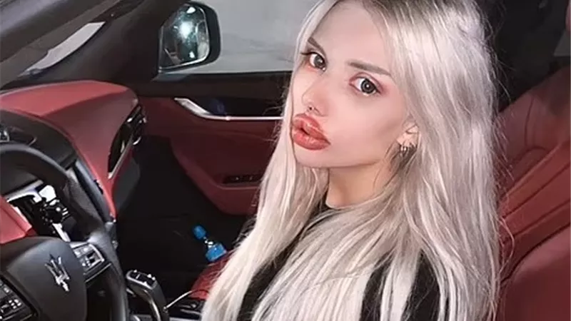 عملية تجميل فاشلة حولت بلوجر روسية إلى مسخ بشري (صور)