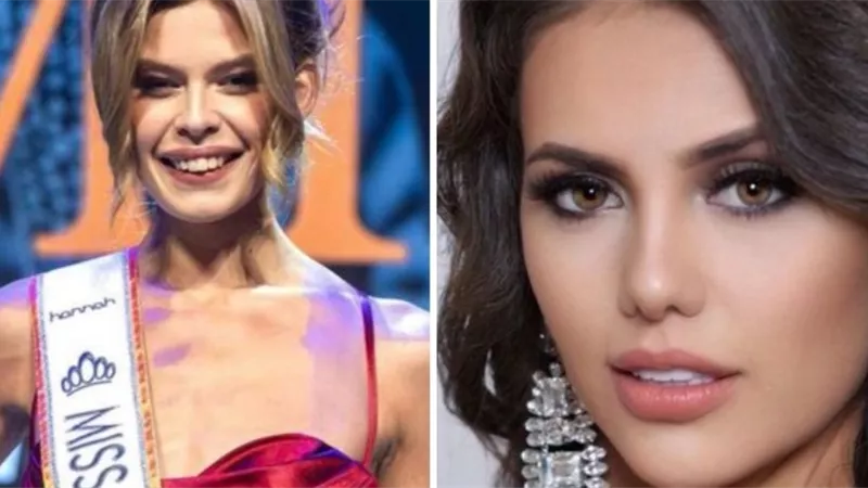 غضب رواد السوشيال ميديا بعد فوز متحول جنسيا بلقب ملكة جمال هولندا (صور)