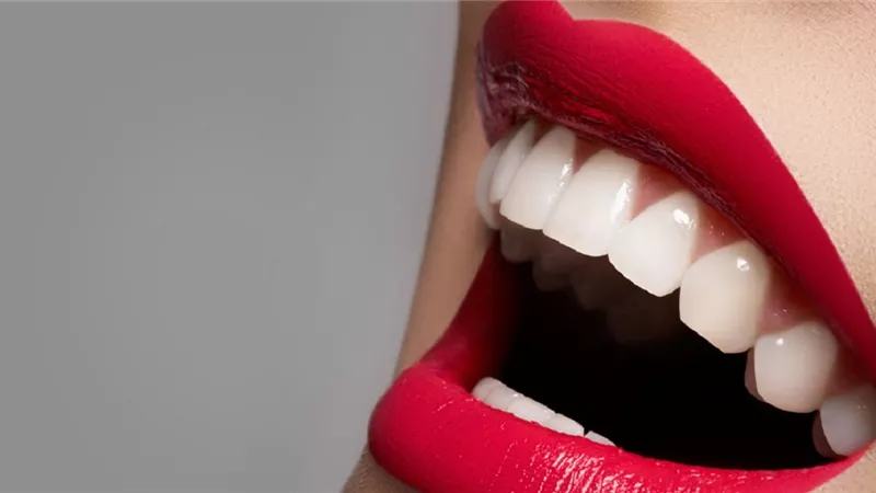 كيفية الحصول على هوليوود اسمايل في 5 خطوات فقط