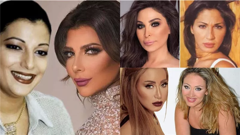 5 فنانات وقعن ضحايا لعمليات التجميل أبرزهن إليسا وأصالة (صور)