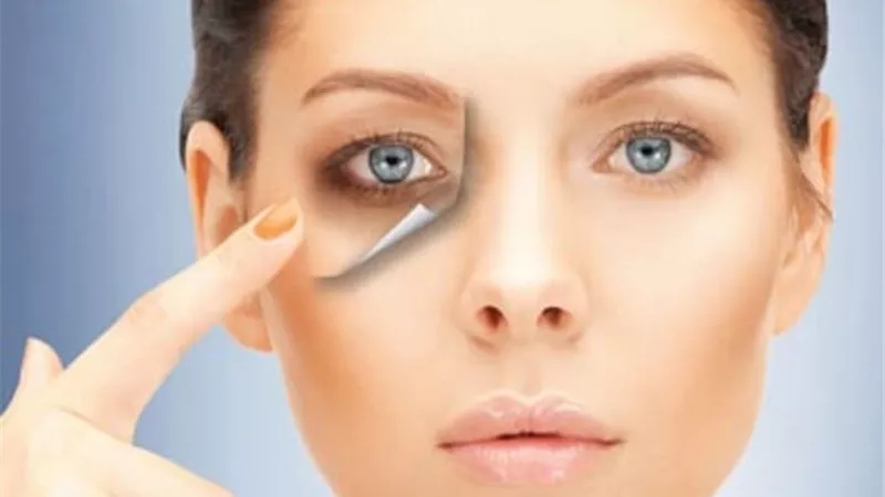 5 طرق للتخلص من الهالات السوداء أسفل العين