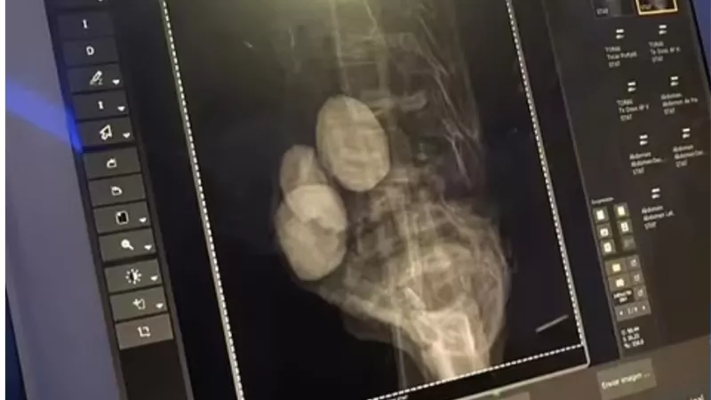طبيب مكسيكي يكشف حقائق صادمة عن الأجسام الفضائية بعد عرضها أمام الكونجرس