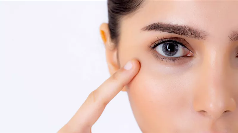 5 طرق للتخلص من الهالات السوداء أسفل العين (إنفوجراف)