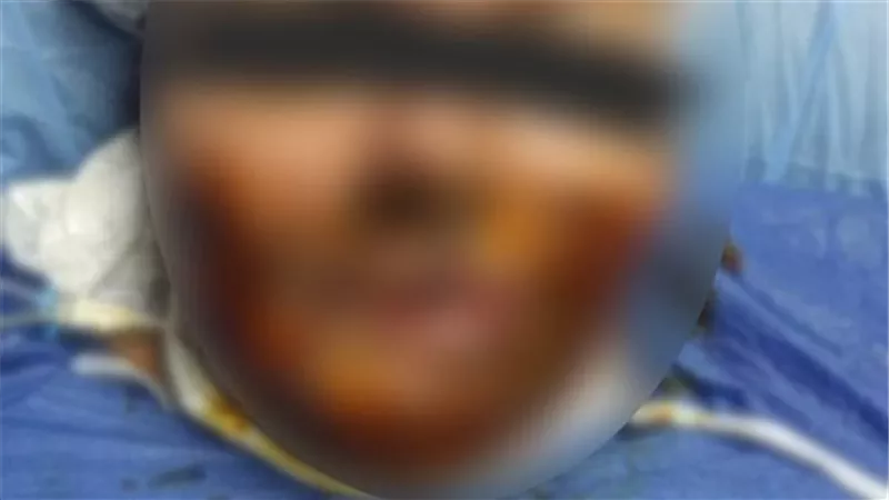 مفاجآت صادمة في أقوال شقيقة ضحايا التشويه بمية النار في منشأة القناطر