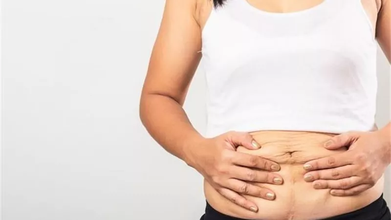 6 نصائح تخلصك من ترهلات البطن بعد الولادة  