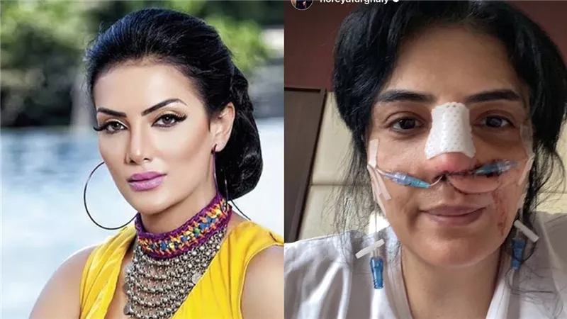 حورية فرغلي .. رحلة معاناة « ساحرة الجنوب» مع المرض والسحر