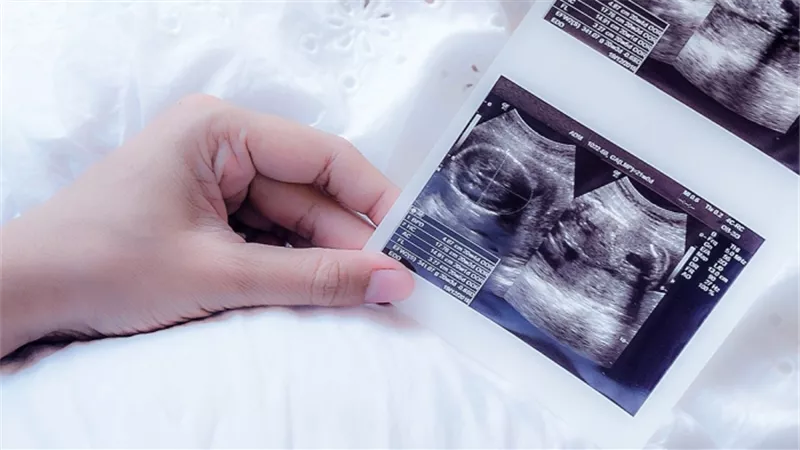 كيف تستخدمين الجدول الصيني لمعرفة نوع الجنين؟