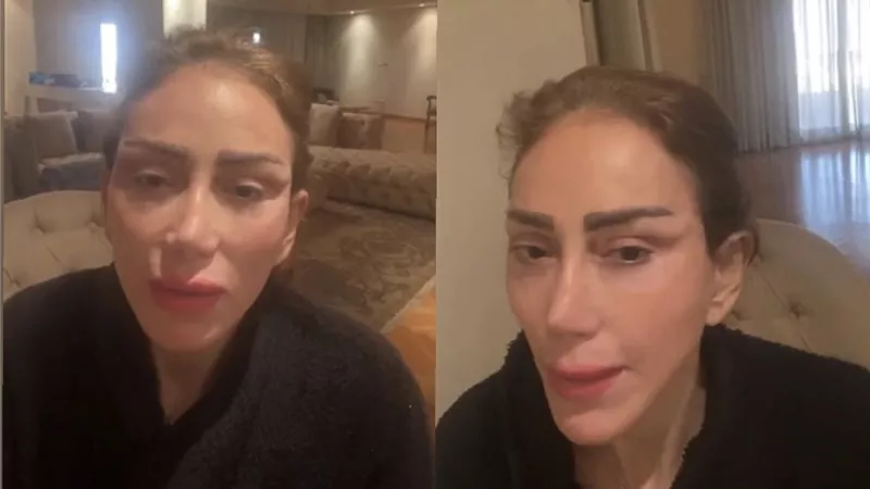 4 نجمات أصابتهن لعنة عمليات التجميل بعد ريهام سعيد